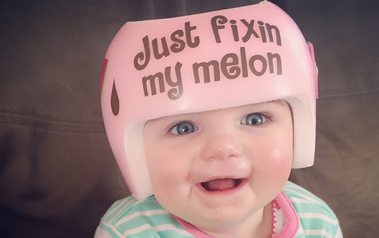 Cranial molding helmet