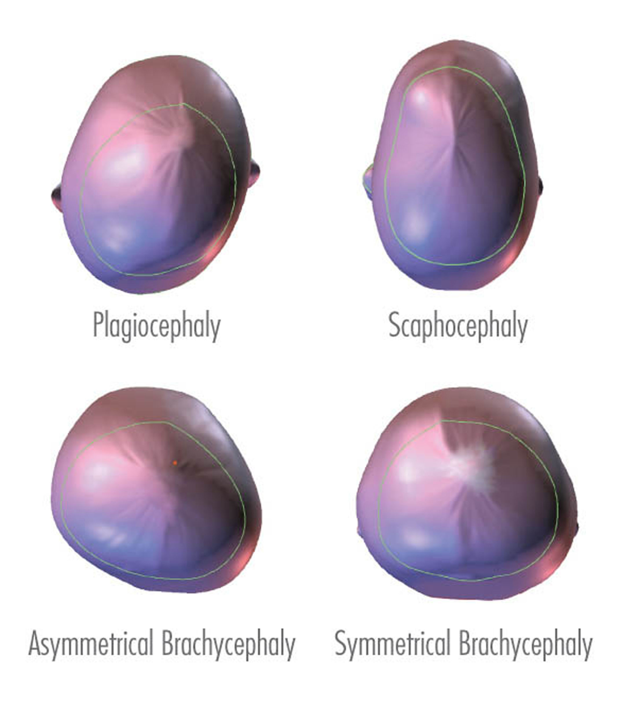 Orthomerica cranial scan examples